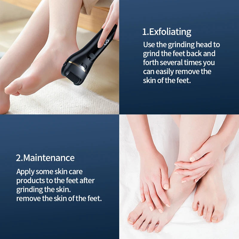 Galeve _ Callus Remover Foot