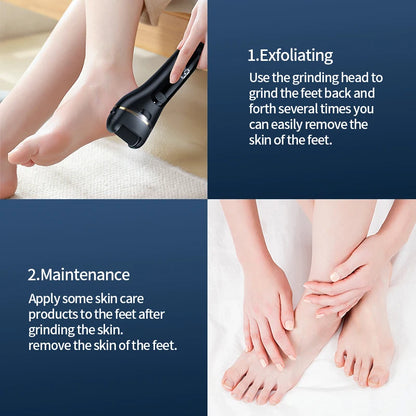 Galeve _ Callus Remover Foot