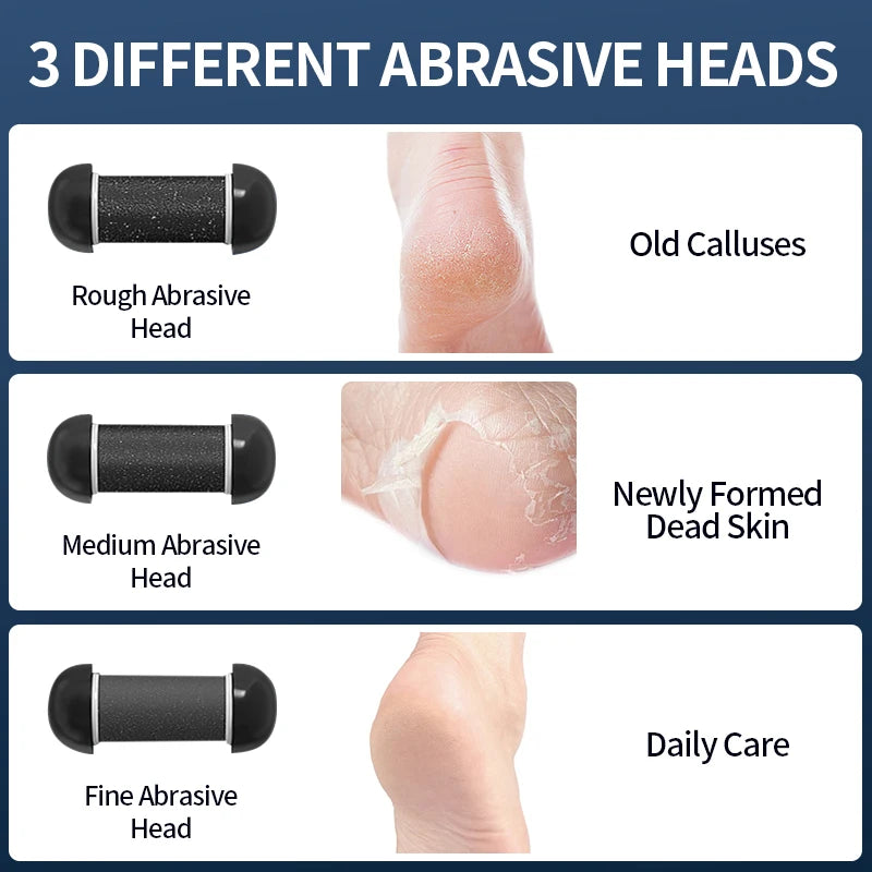 Galeve _ Callus Remover Foot