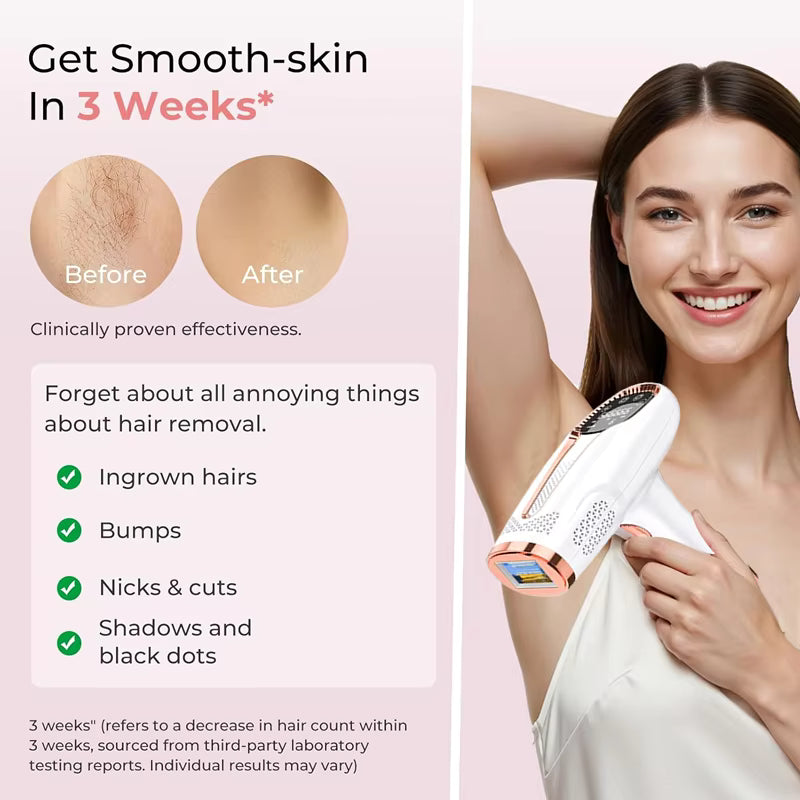 Galeve _ IPL Hair Remover